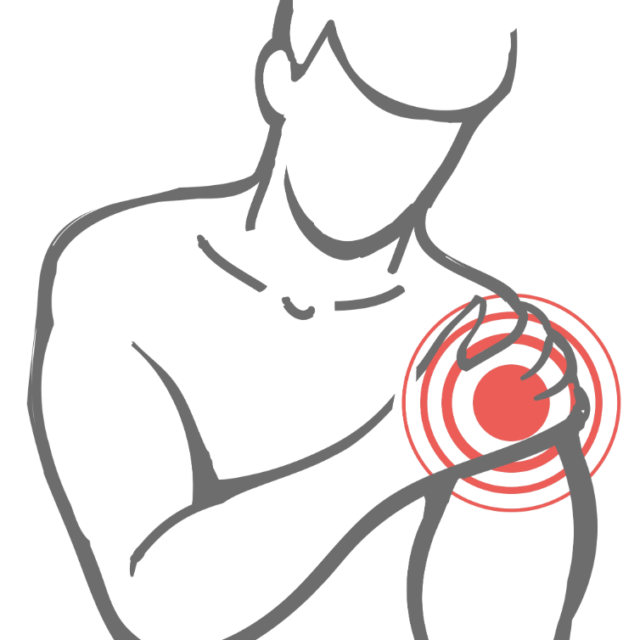 肩インピンジメント症候群